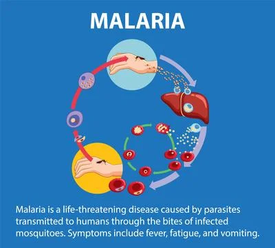 Life Cycle of Malaria Parasite: A Visual Guide Stock Illustration