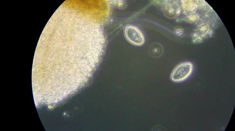 Life in the drop of water under microscope Видео 33661111