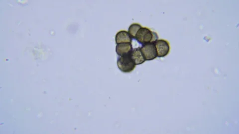 Life in sewage under Bright field Microscope 스톡 동영상 80387486