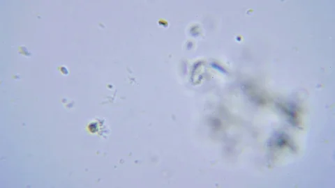 Life in sewage under Bright field Microscope Video stock 80387488
