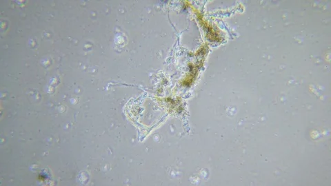 Life in sewage under Phase contrast Microscope 스톡 동영상 80375875