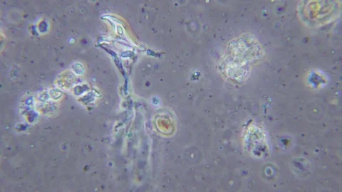 Life in sewage under Phase contrast Microscope 스톡 동영상 80432061