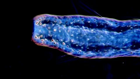 Life Under Dark Field Microscope: Aeolosoma Worms in Action 動画素材 317925483