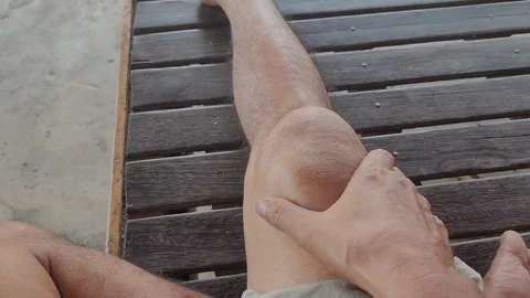 Ligament sprain, Patella, dislocation of the kneecap Stock Footage 251035886