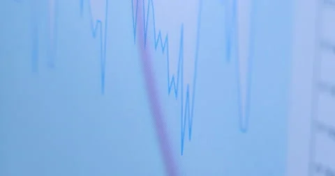 Light blue chart shows rising and falling of currency rate Video stock 157098985