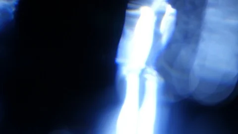 Light leak in 4K quality on dark background with.Real lens flare Stock Footage 86712973