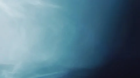 Light leak lens flare, light effect | Stock Video | Pond5