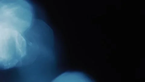 Light leaks on dark background with real... | Stock Video | Pond5