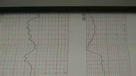 Line Graph Printing 2 Video stock 280025