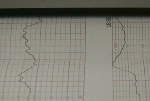 Line Graph Printing 2 Video stock 284070