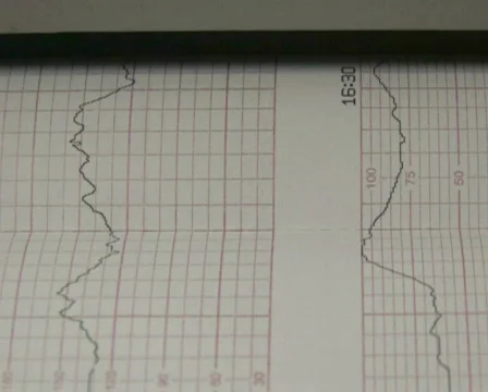 Line Graph Printing 2 Video stock 284426
