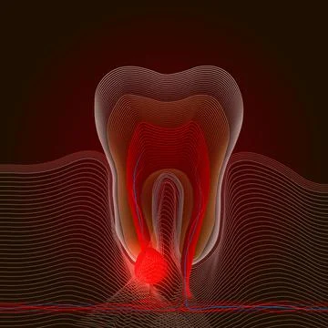 Linear stylization of dental disease with a point of pain and inflammation. M Illustrazione stock