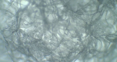 Linen branches under a microscope. Floating bacteria within mysterious web net Video stock 199224672