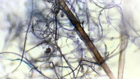 Lint under a microscope Video stock 153451450