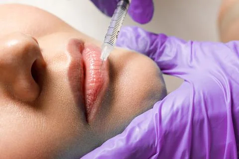 Lip augmentation and correction procedure in a cosmetology salon. The specialist Stock Photos