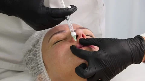 Lip augmentation and volume with fillers in a beauty salon Stock Footage 167827471