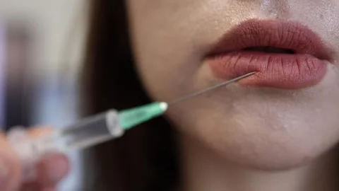 Lip augmentation beauty procedure Video stock 335172473
