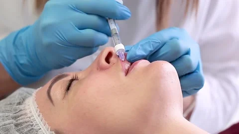 Lip augmentation. Stock Footage 143589585