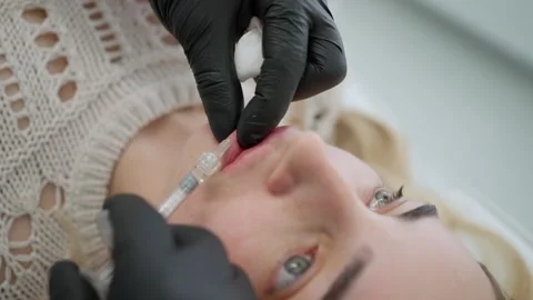 Lip augmentation injections are close Stock-Footage 245729542