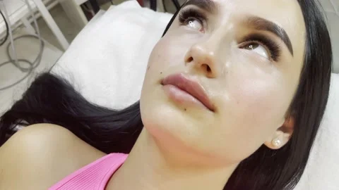 Lip augmentation procedure close-up. The face of a beautiful girl after the Stock Footage 157775796