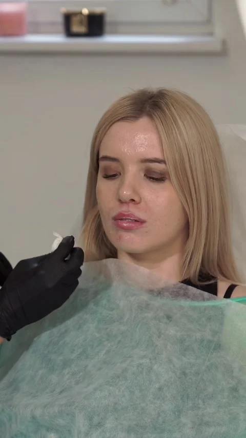 Lip augmentation procedure Video stock 199957966