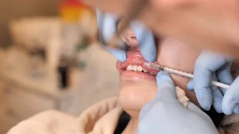 Lip injection plastic surgery. Close-up of a young, male doctor doing lip Stock Footage 123294072