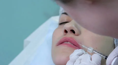 Lip injection plastic surgery. Closeup upper lip Stock Footage 58933993