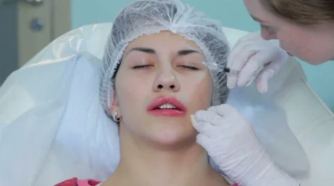 Lip injection plastic surgery  Stock Footage 58933935