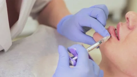 Lip pumping - volume modeling on the face 動画素材 147174606