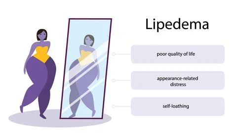 Lipedema disease concept vector design Stock Illustration