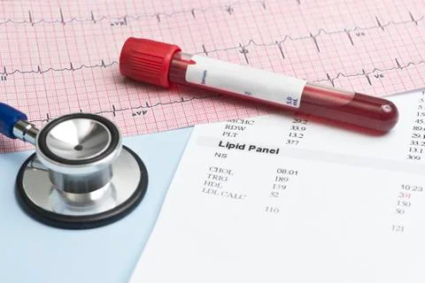 Lipid panel ekg Stock Photos