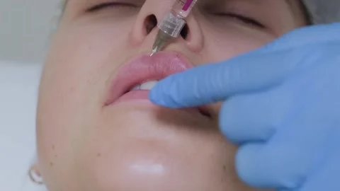 Lips augmentation procedure in the aesthetic cosmetology clinic. 库存影片 253370149