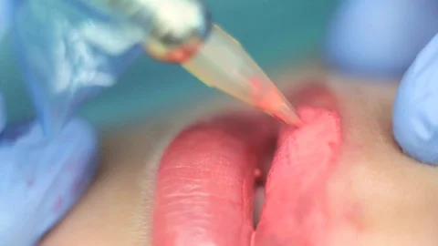 Lips Pigmentation Permanent Makeup Stock Footage 101368276