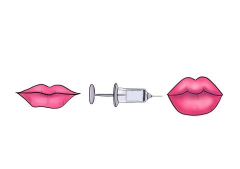 Lips plastic Stock Illustration