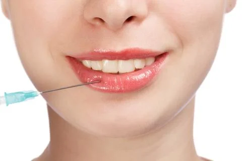Lips plastic surgery injection on young woman face Foto stock