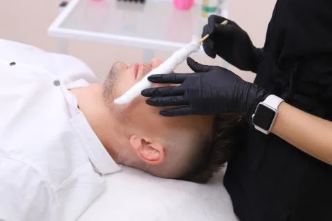 Liquid nitrogen therapy. Stock Photos