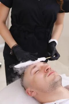 Liquid nitrogen therapy. Stock Photos