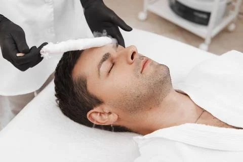 Liquid nitrogen therapy. Foto stock
