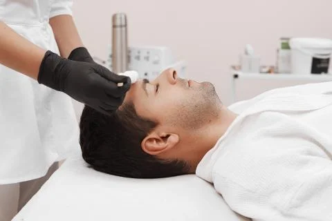 Liquid nitrogen therapy. Stock Photos