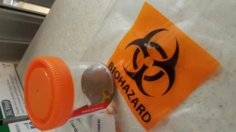 Liquid Stool in Sample Cup with Biohazard Bag Stock Photos