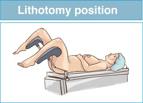 Lithotomy position vector illustration Stock Illustration