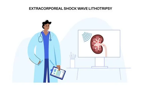 Lithotripsy procedure concept Illustrazione stock