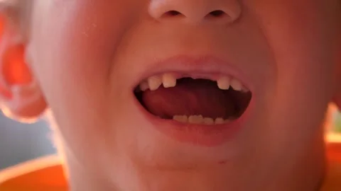Little boy showing off his missing front tooth Stock Footage 325723077