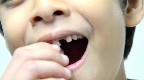 Little boy touching his toothless Stockbeeldmateriaal 45872168