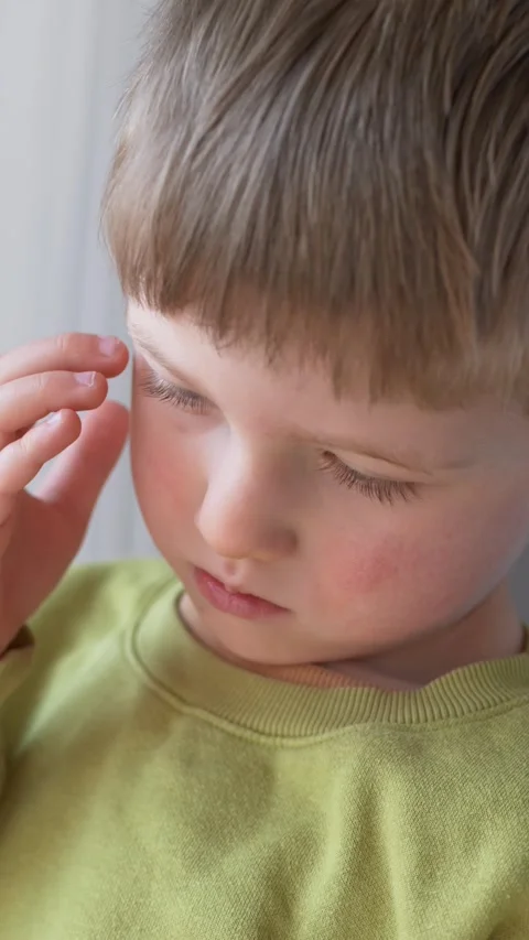 Little boy touching itchy face showing rash and discomfort. Child health concept Stock Footage 330973625
