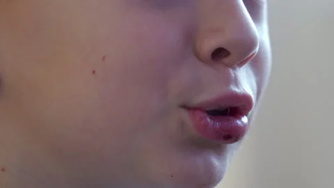 Little Boy's Face with Swollen Split Lip Stock Footage 300759036