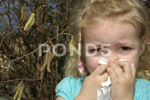 Little Girl With Pollen Allergy