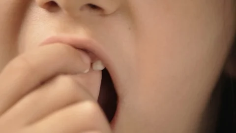 Little Girl Pulling Deciduous Tooth Video stock 100071933