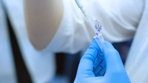 Little test tubes Stock Footage 111521859