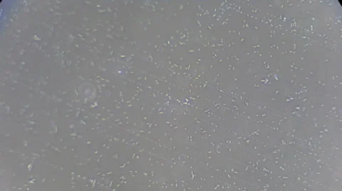 Live bacteria movements under microscope Video stock 33661839
